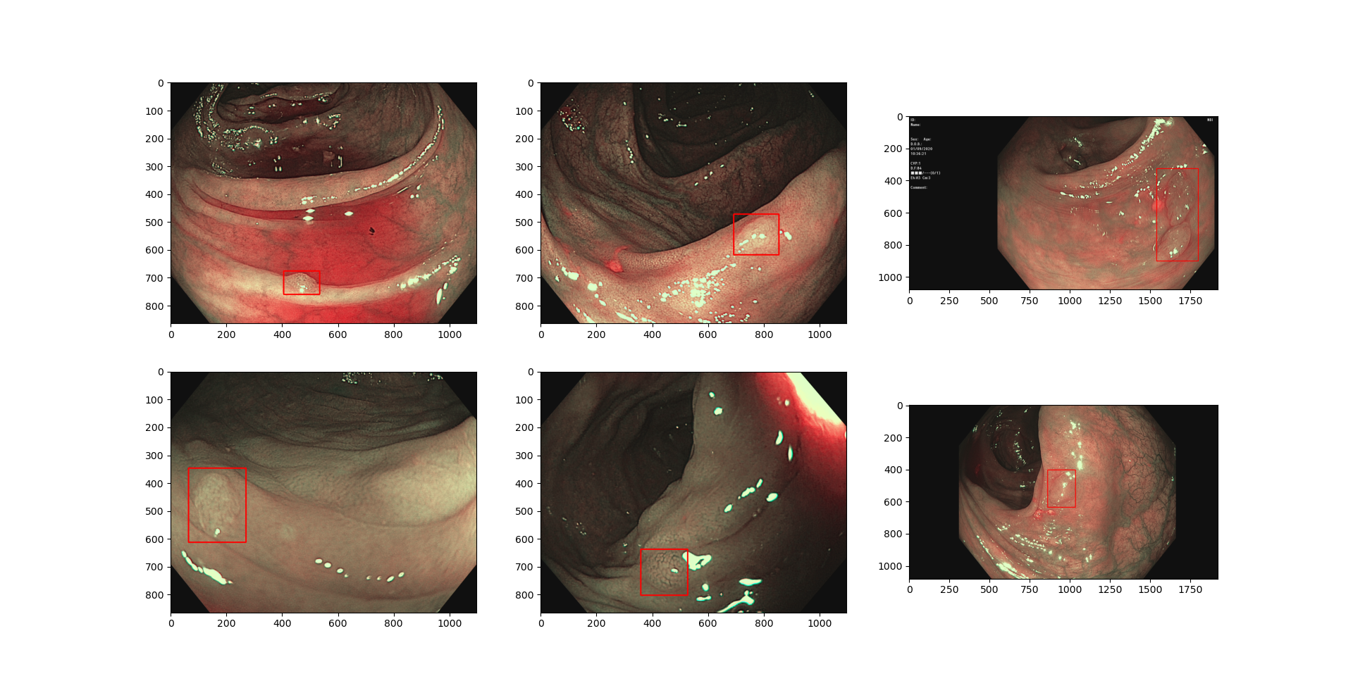 Figure 1: Examples of annotated polyps with bounding box. The information of the bounding box is provided in the attached excel file [y,x,w,h]. 
